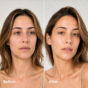 Silk Peptide EGF serum before and after comparison, first example
