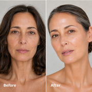 Silk Peptide EGF serum before and after comparison, second example