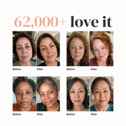 Silk Peptide EGF serum customer before and after comparisons